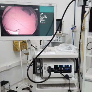 IA fortalece diagnóstico precoce do câncer de intestino e exames