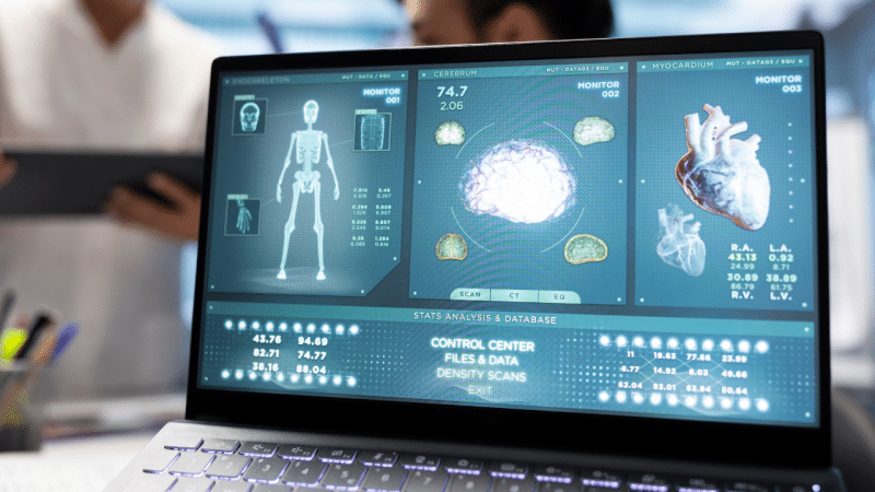 Tecnologias digitais ampliam acompanhamento clínico e transformam cuidado de pessoas com epilepsia
