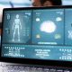 Tecnologias digitais ampliam acompanhamento clínico e transformam cuidado de pessoas com epilepsia
