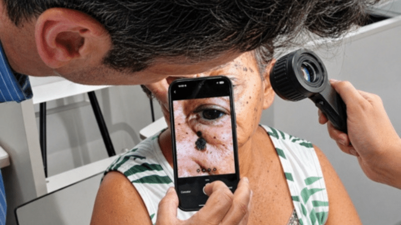 AI Pathology usa IA para transformar triagem de câncer de pele